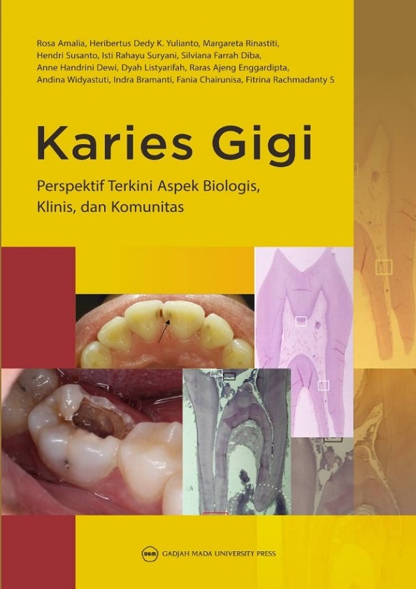 KARIES GIGI: Perspektif Terkini Aspek Biologis, Klinis, dan Komunitas